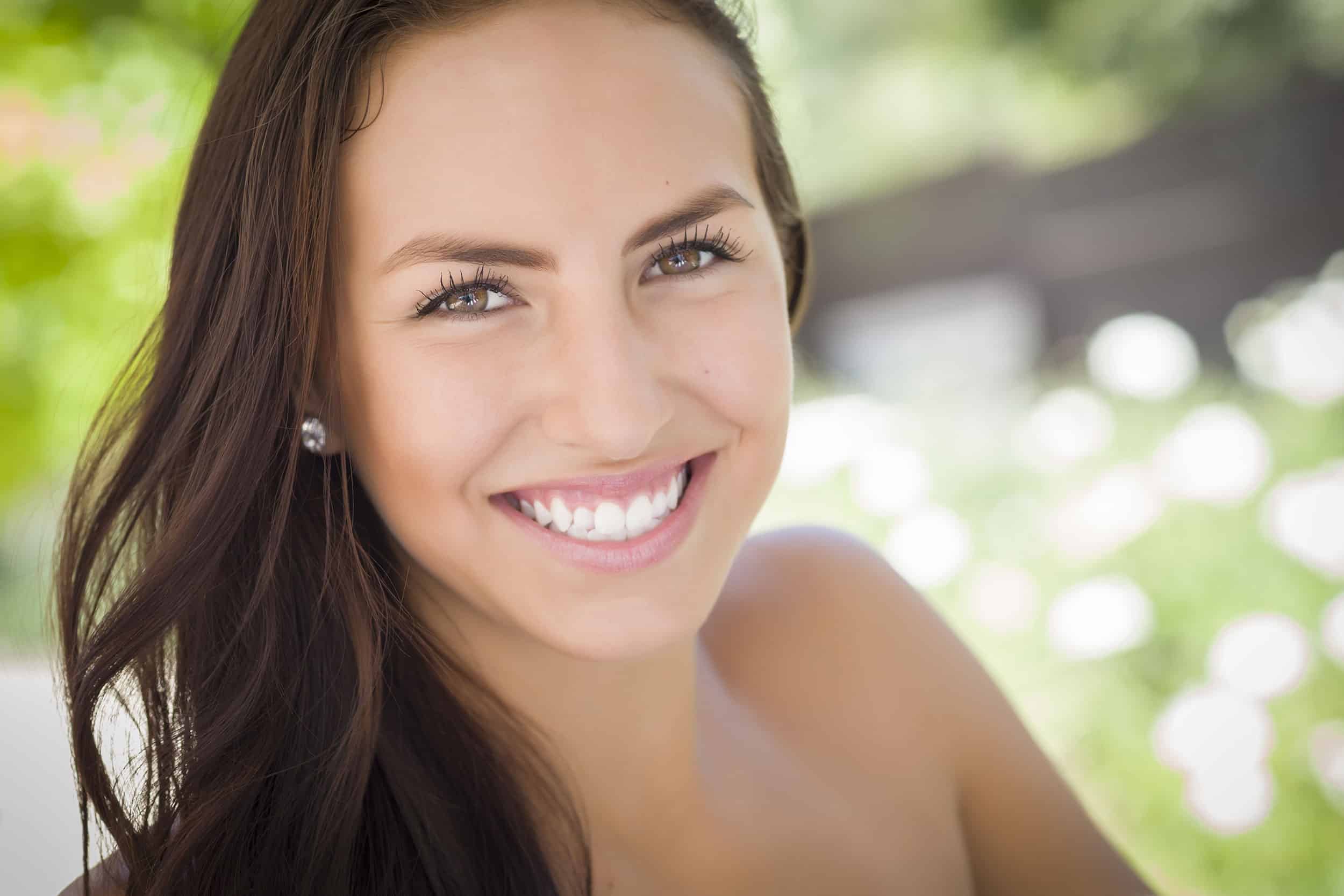 Top Benefits of Professional Teeth Whitening in Houston